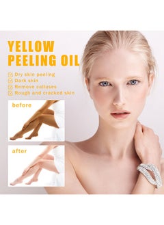 OUHOE Yellow Peeling Oil Super Strength Exfoliating Dark Skin for Body, Cleansing and Moisturizing100ml  - Image 4