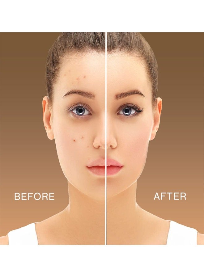 GLAZZI Pro Conceal HD Concealer, Used To Neutralize Redness Phenomena Such as Acne Marks and Other Skin Sensitivities, Can Be Used Before Makeup, Perfectly Blends Into Liquid Foundation - Image 4