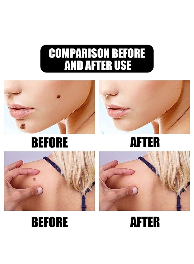 إيلهو Aclive Skin Mole Removal,Natural Skin Mole Remover Liquid 10ml - Image 4