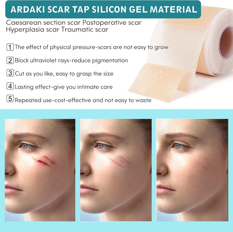 ARDAKI Silicone Scar SheetsSilicone Scar TapeScar Tape for Surgical ScarsSilicone Scar Removal for SurgicalCSectionTummy TuckKeloid Scars Face Tape Keloid Bump Removal 16X 60 Roll15M - Image 3