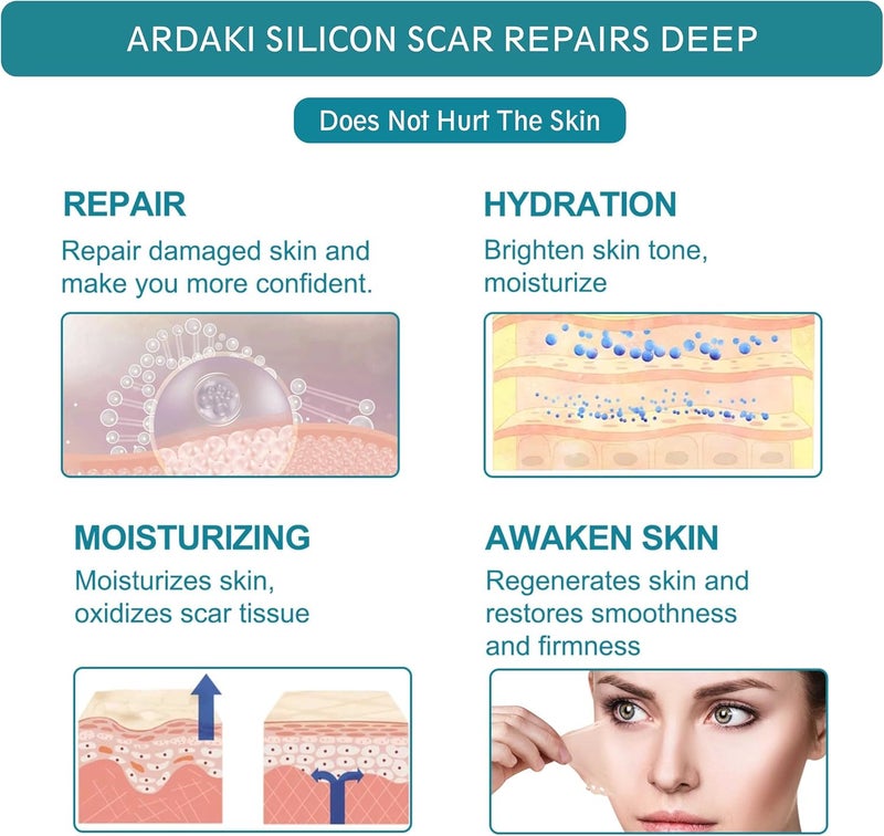 ARDAKI Silicone Scar SheetsSilicone Scar TapeScar Tape for Surgical ScarsSilicone Scar Removal for SurgicalCSectionTummy TuckKeloid Scars Face Tape Keloid Bump Removal 16X 60 Roll15M - Image 4