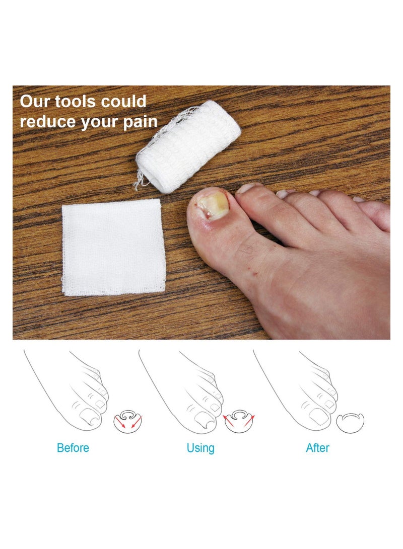 SYOSI 5 Pairs Elastic Silicone Ingrown Toenail Correction Sleeves Ingrown Toenail Corrector Ingrown Toenail Lifter Big Toe Sleeves Foot Care Toe Protector Paronychia Treatment Pedicure Tool Set - Image 2