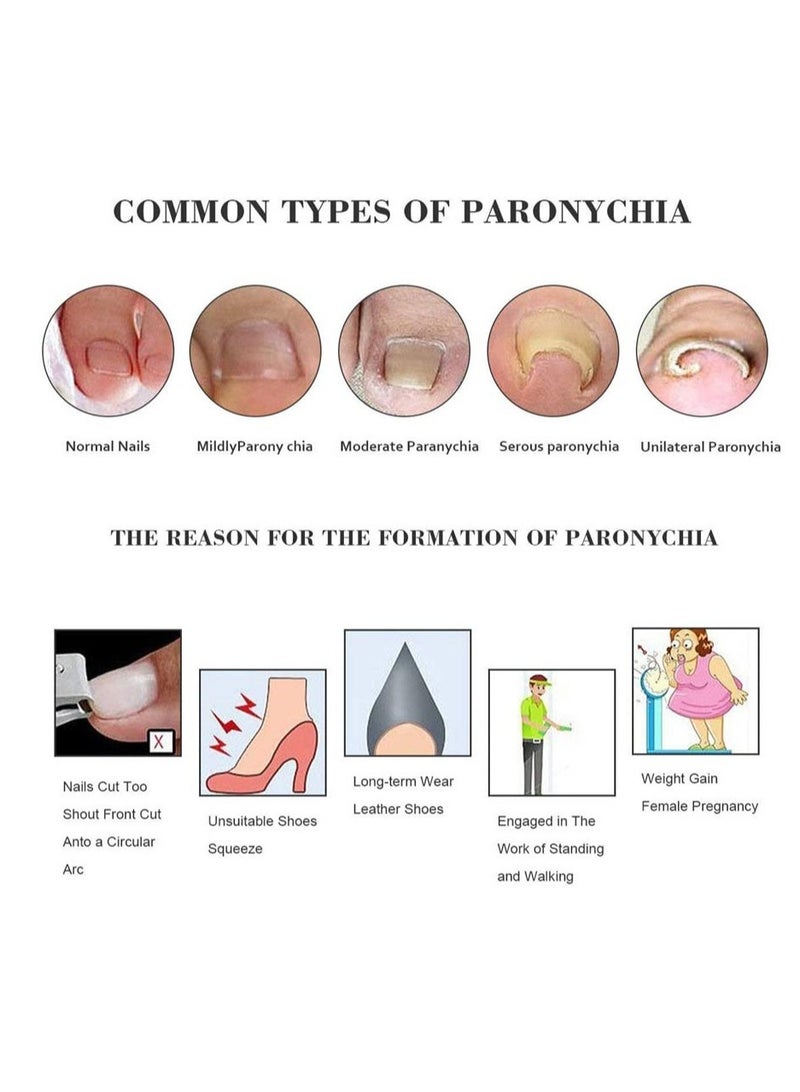 SYOSI 5 Pairs Elastic Silicone Ingrown Toenail Correction Sleeves Ingrown Toenail Corrector Ingrown Toenail Lifter Big Toe Sleeves Foot Care Toe Protector Paronychia Treatment Pedicure Tool Set - Image 3