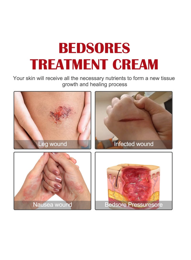 EELHOE Bedsore Repair Cream, Wound Healing Ointment, Fast-Acting Bedsore Cream, Rapid Wound Healing Gel, Bedsore Wound Care, Pressure Sore Relief Cream 20g - Image 2