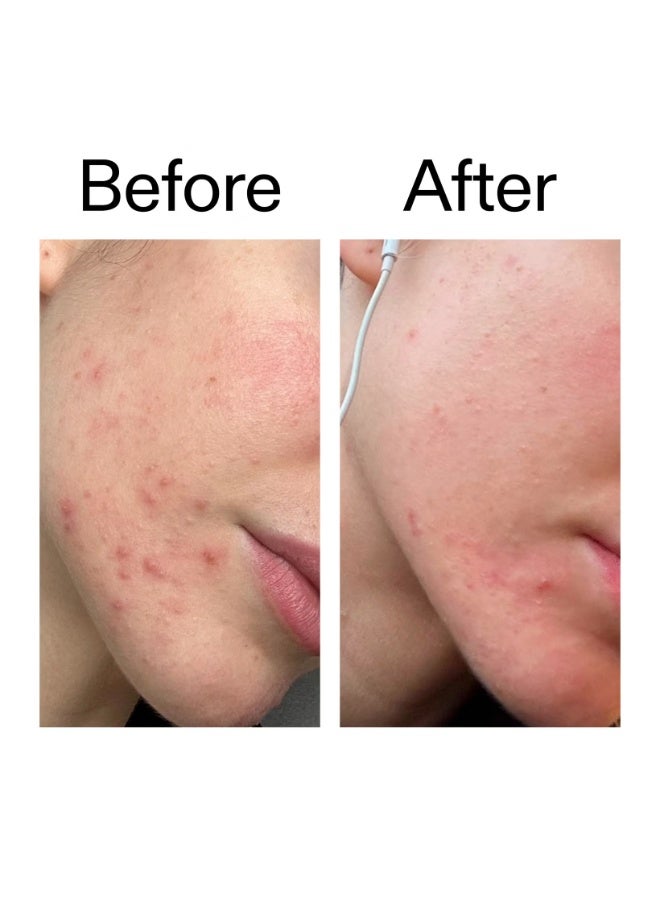 مرطب إنكي ليست لإزالة العيوب بتركيز ٢٪ نوفو ريتين ٥٠ مل - Image 4