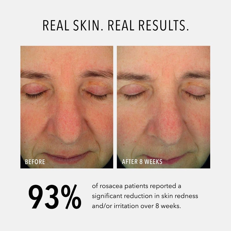 Hydropeptide Soothing Serum, Moisturizing & Anti-Aging Peptide Facial Serum, 1 Ounce - Image 4