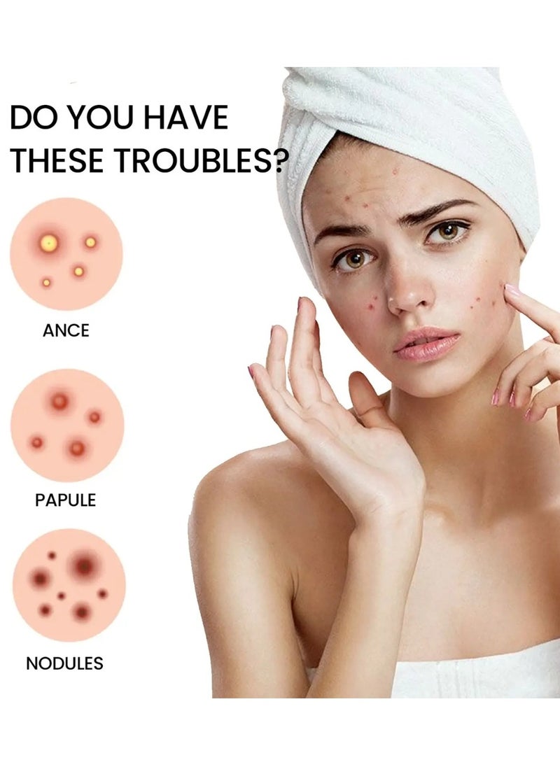 200 Pcs Pimple Patches Hydrocolloid Non Drying Acne Patches for Face Colorful Cloud Pimple Spot Sticker with Hyaluronic Acid Tea Tree Oil and Centella Oil Pimple Patches for Covering Blemishes and Zits