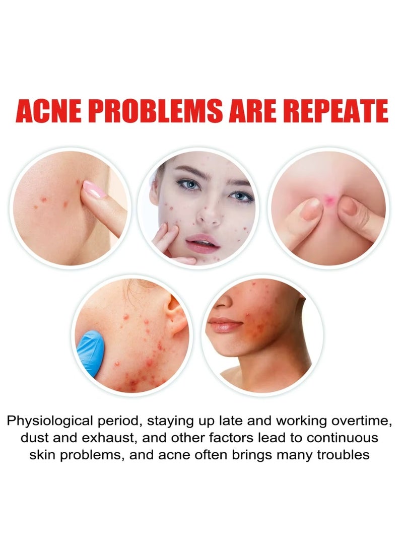 200 Pcs Pimple Patches Hydrocolloid Non Drying Acne Patches for Face Colorful Cloud Pimple Spot Sticker with Hyaluronic Acid Tea Tree Oil and Centella Oil Pimple Patches for Covering Blemishes and Zits