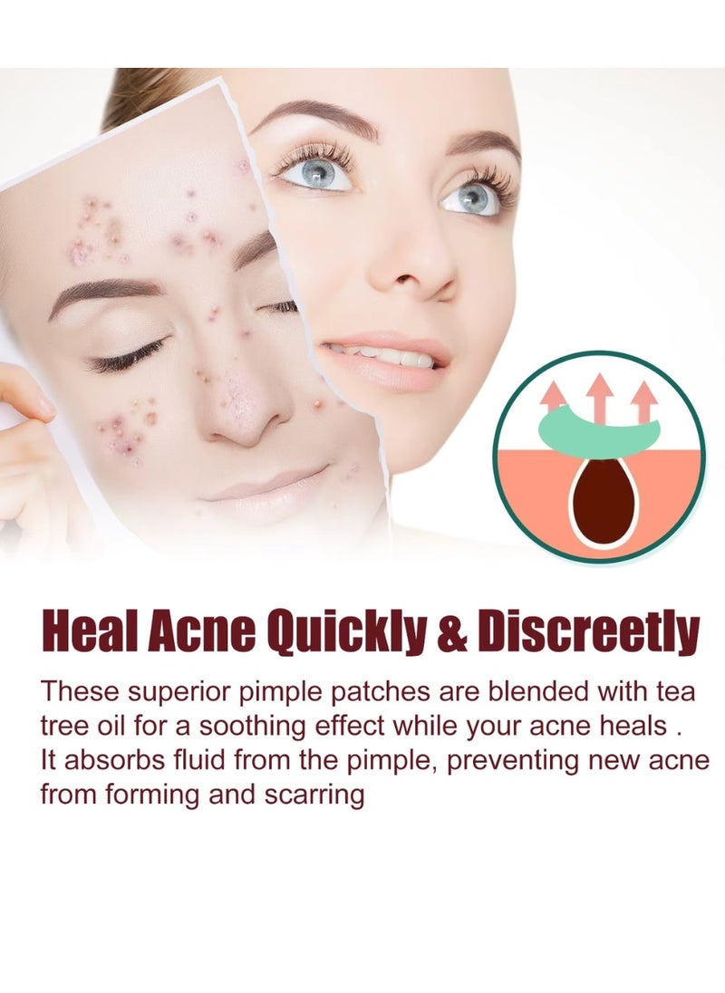 200 Pcs Pimple Patches Hydrocolloid Non Drying Acne Patches for Face Colorful Cloud Pimple Spot Sticker with Hyaluronic Acid Tea Tree Oil and Centella Oil Pimple Patches for Covering Blemishes and Zits
