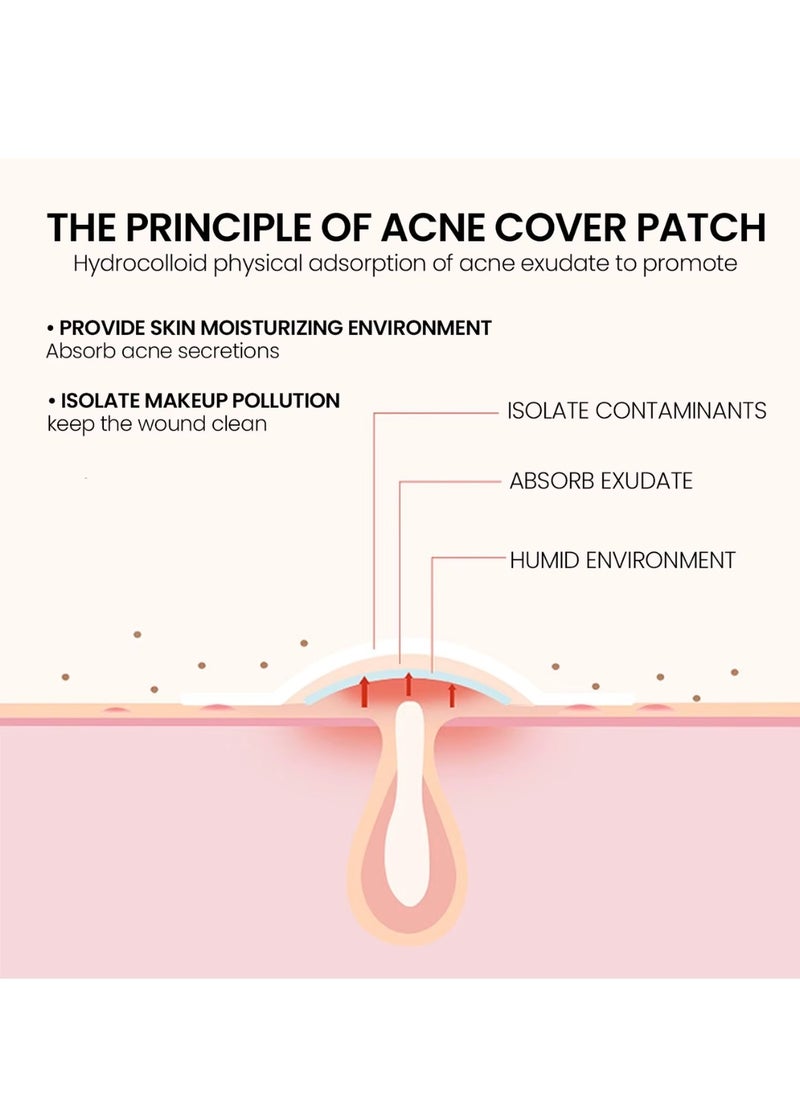 200 Pcs Pimple Patches Hydrocolloid Non Drying Acne Patches for Face Colorful Cloud Pimple Spot Sticker with Hyaluronic Acid Tea Tree Oil and Centella Oil Pimple Patches for Covering Blemishes and Zits
