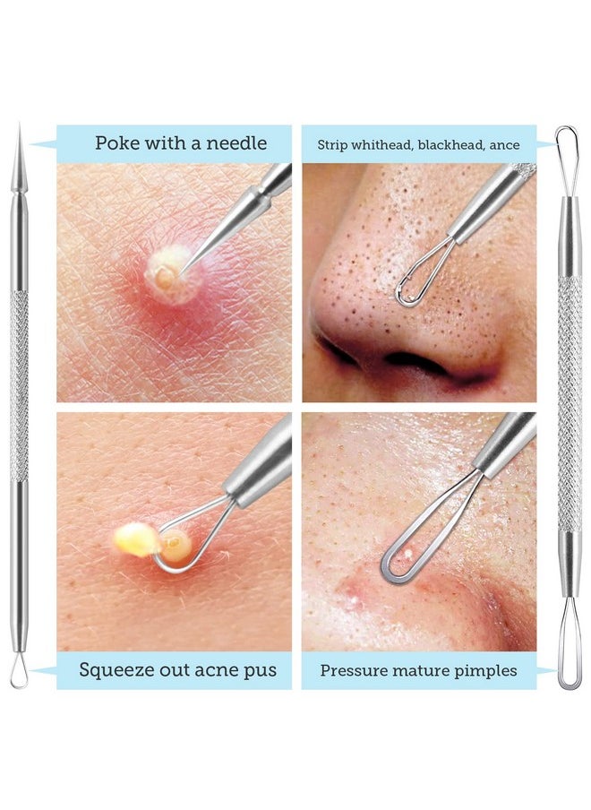 LitBear LitBear Pore Prep Tool, Blackhead Remover Pimple Popper Tool Kit, Stainless Steel Blackhead Extractions Tool for Acne, Whitehead Popping, Blemish, Comedone  - Image 5