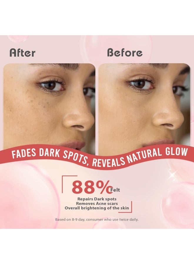 Glamveda 2% Kojic Acid Face Serum | Reduces Dark Spots, Pigmentation & Blemishes | With Alpha Arbutin & Niacinamide | Skin Brightening & Hydration | For Men & Women | All Skin types | 30 ml - Image 3
