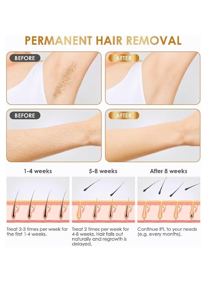 جهاز ازالة الشعر بالليزر، مزيل دائم بدون الم لتقليل نمو الشعر في المنزل لكامل الجسم SE4 - Image 2