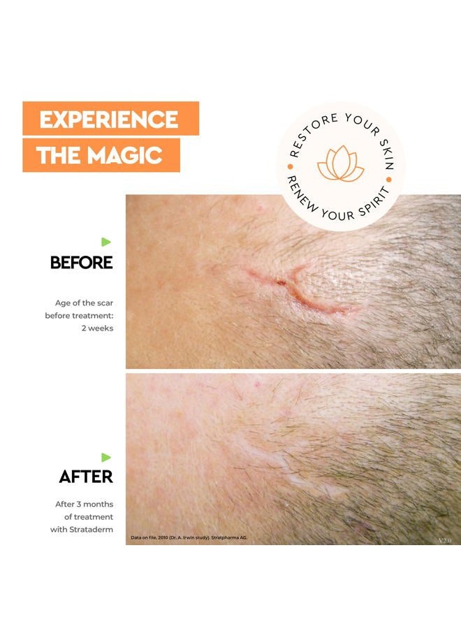 strataderm Professional Scar Therapy Gel | Old and New Scars from General Surgery, Trauma, Wounds, Burns, Bites, Acne & Skin Disease | Reduces Redness, Discoloration, Discomfort & Itch | 20g (0.7oz) - Image 3