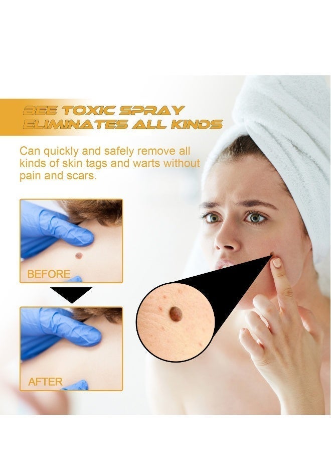 SOL LORA Tag Recede Bee Venom Repair Spray, A Gentle Safe Portable Wart Removal Spray with Natural Extracts for All Skin Types，Universal for Both Men and Women Wart Removal .Protecting Health and Beauty. - Image 2