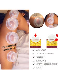 SYOSI 4 Sizes Cupping Therapy Set, Professional Cupping Therapy Studio and Household Silicone Cupping Set, Stronger Suction, Suitable for Myofascial Massage, Muscle, Nerve, Joint Pain  - Image 3