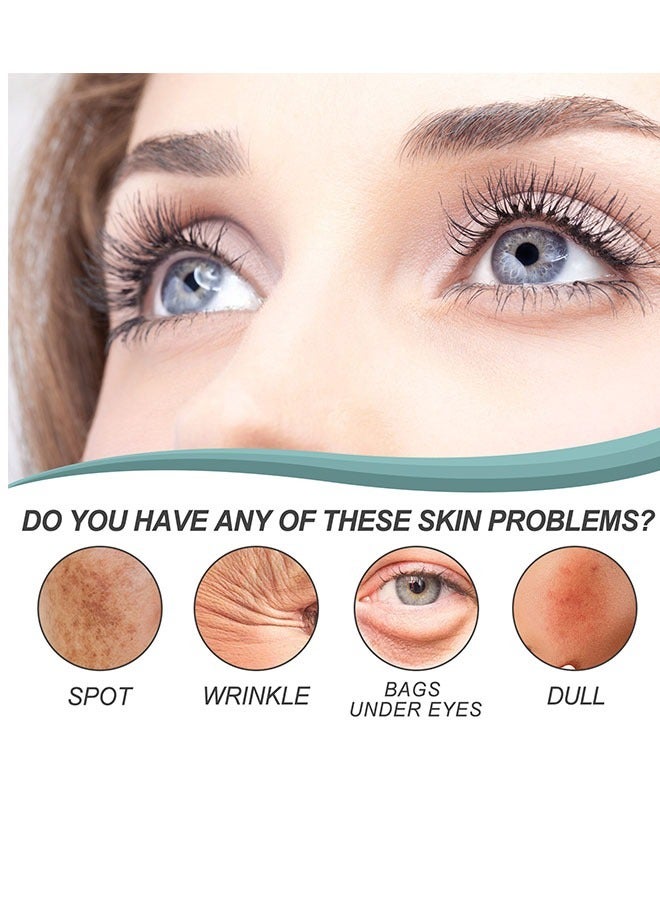 EELHOE Dark Spot Corrector Remover Cream 30g, Hyperpigmentation and Melasma Treatment, Moisturizes and Nourishes Skin, Whitening Moisturizing Brighten, Complexion Improving Skin, Remover Dark Spot Cream - Image 3