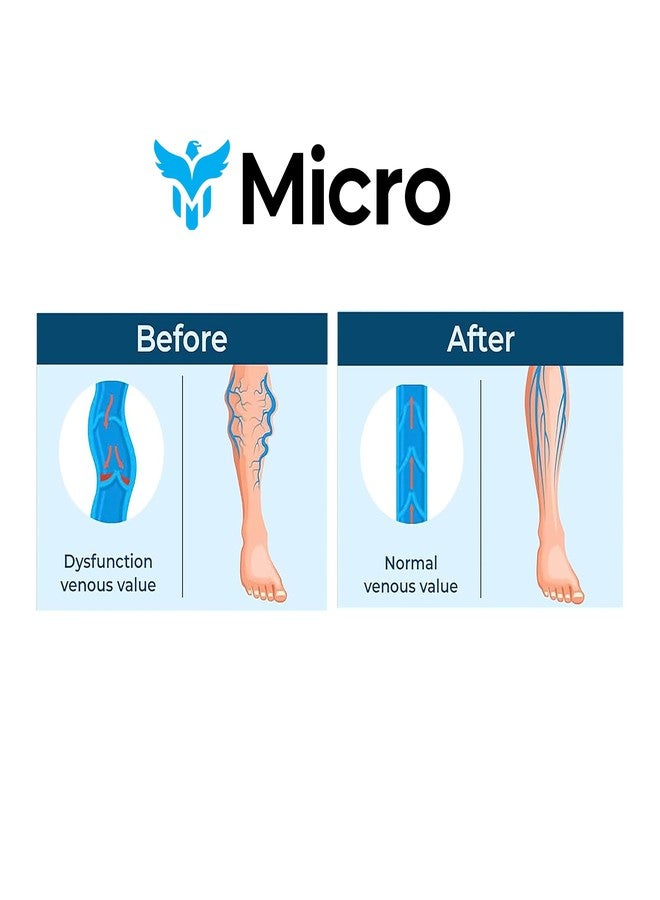 مايكرو جوارب مايكرو ميديتكس | جوارب ضاغطة | جوارب لعلاج الدوالي | جوارب ضغط طبية لعلاج الدوالي | جوارب ضاغطة للنساء والرجال | زوج من قطعتين | (صغير) - Image 4