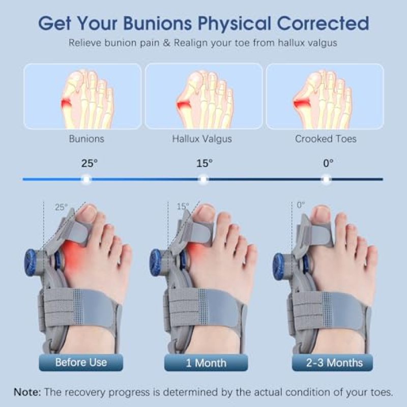 Bunion Corrector Adjustable Tension Control - Ultra-Soft Silicone Cushion Adjustable Toe Separator for Men Women Home Walking Day Night Use - Image 2