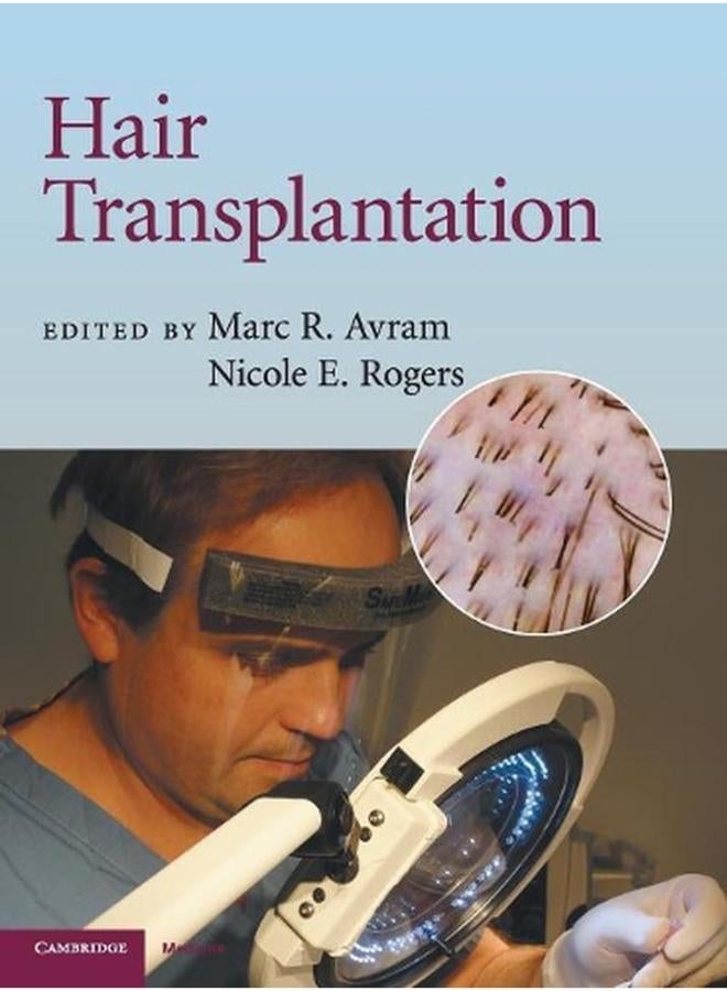 Hair Transplantation (Cambridge Medicine)