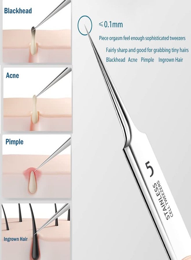 Jedrey 2Pcs Professional Facial Blackhead Remover Tweezers and Pimple Extractor Acne Treatment Tool for Acne Pimples Comedowns Blemishes or Splinters Removal - Image 2