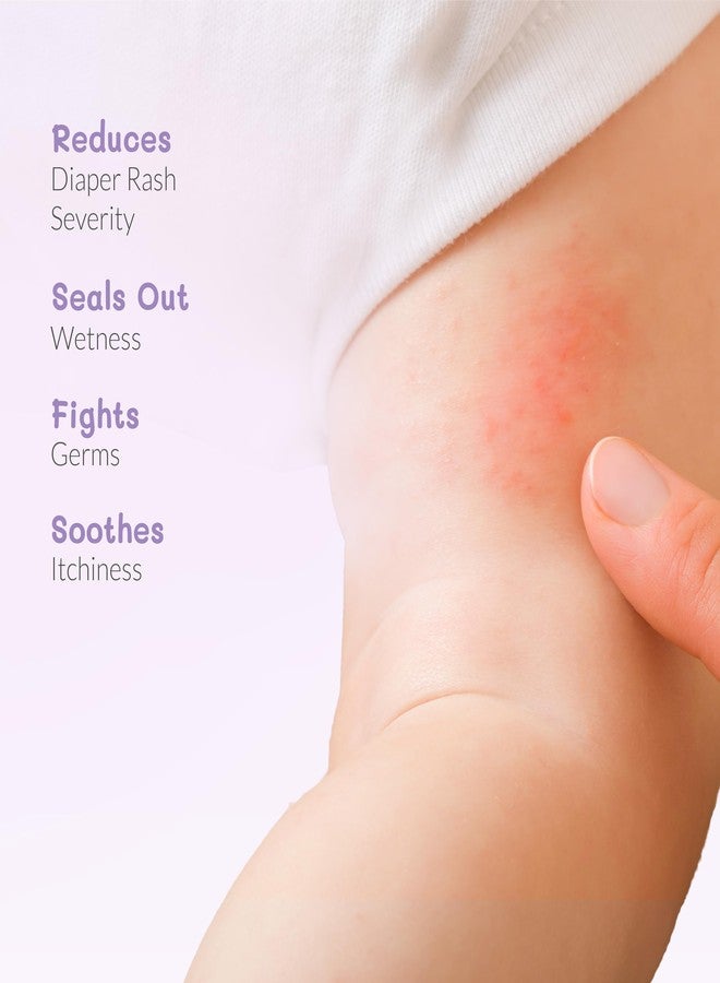 AreoVeda Diaper Rash Cream (100 gm), Suitable for newborns & babies, 15% Zinc Oxide, Prevents & Soothes Rashes from Day 1, Relieves Itchiness & Discomfort - Image 3
