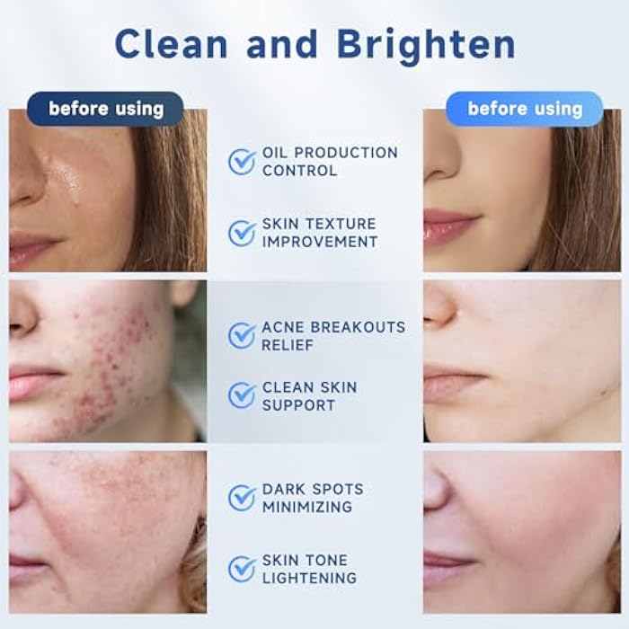 Ragkun Glycolic Acid Pads, Exfoliating Resurfacing Pads for Face with Salicylic Acid Pad with Tea Tree Oil, Exfoliating Face Peel & Radiance Deep Cleaning Effect, 60 Count - Image 5