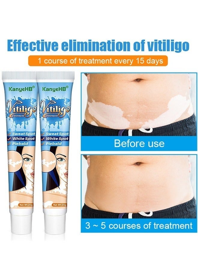 KanyeHB - Vitiligo Ointment, Vitiligo Treatment For Skin Vitiligo, Vitiligo Care Cream For Reduce White Spots And Improve Skin Pigmentation 20G - Image 1