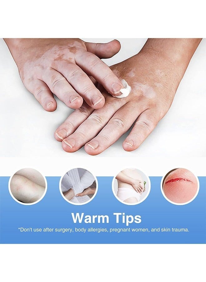 KanyeHB - Vitiligo Ointment, Vitiligo Treatment For Skin Vitiligo, Vitiligo Care Cream For Reduce White Spots And Improve Skin Pigmentation 20G - Image 1