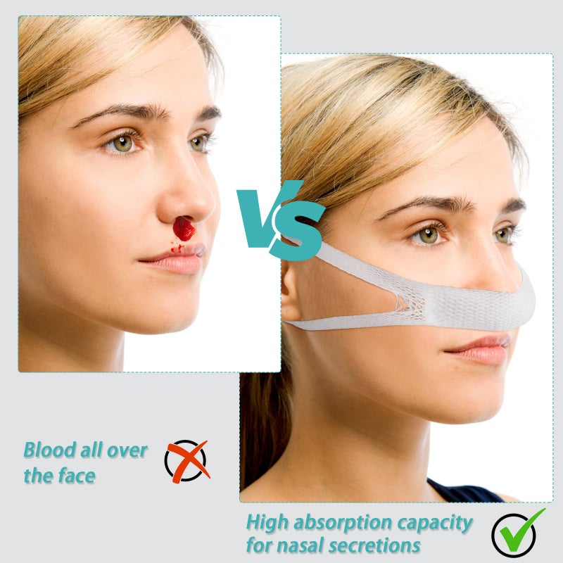 Patelai Elastic Nose Bandage, External Nasal Bandage Dressing Holder with High Absorption Capacity for Nose, White(20 Pcs) - Image 5