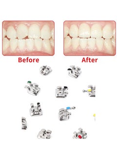 HaLunhi 20 pieces, orthodontic brackets, metal brackets, mini straight wire brackets, without hook, Mini MBT 022 Slot No Hook  - Image 3