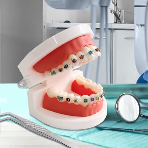 Ceonam Dental Orthodontic Teeth Model with Colorful Braces, Professional Denture Mouth Model Demonstration Study Tool for Dentistry Students and Orthodontists, Tooth Teaching Equipment with Bracket Supplies - Image 4
