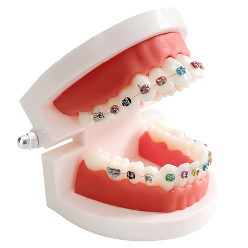Ceonam Dental Orthodontic Teeth Model with Colorful Braces, Professional Denture Mouth Model Demonstration Study Tool for Dentistry Students and Orthodontists, Tooth Teaching Equipment with Bracket Supplies - Image 1