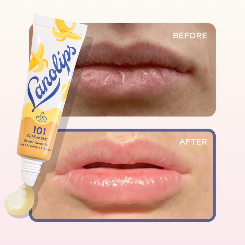 Lanolips Lanolin 101 Multipurpose Ointment - Lanolin Lip Balm & Healing Ointment for Skin Barrier Repair - Moisturizer for Dry Lips, Cuticles & Elbows - No Petroleum Formula - Banana Cream Pie (0.35 oz) - Image 5