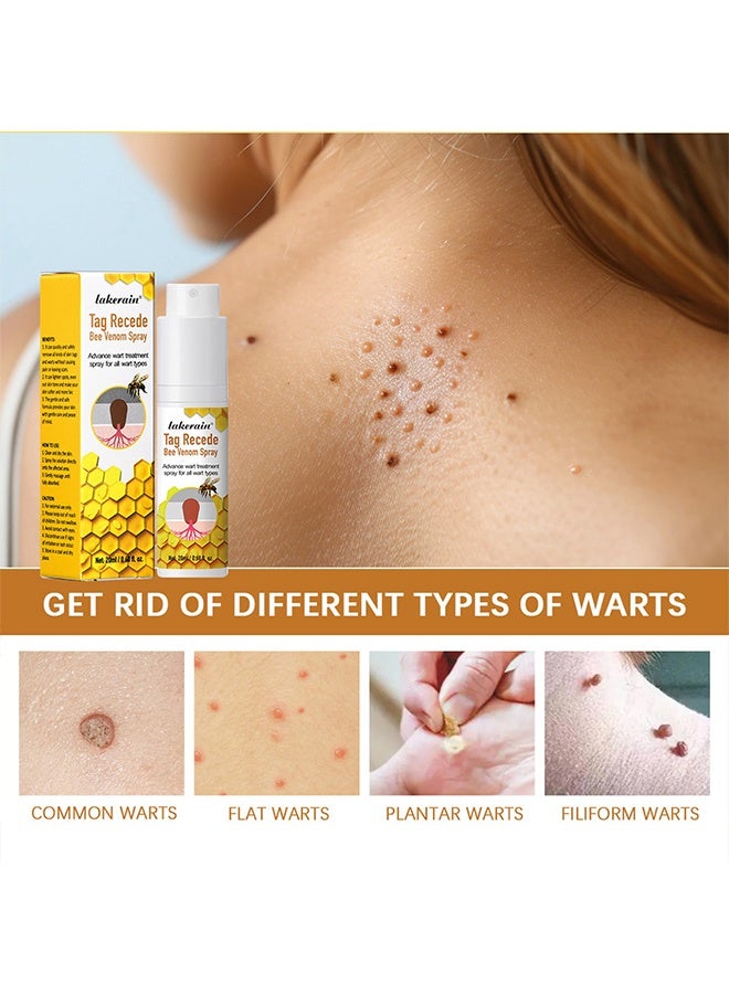 lakerain Tag Recede Bee Venom Spray Wart Treatment Spray Bee Venom Wart and Skin Tags Removal Treatment Spray Wart Remover Bee Venom Skin Tag Removal Spray Acne Removal Spray - Image 4