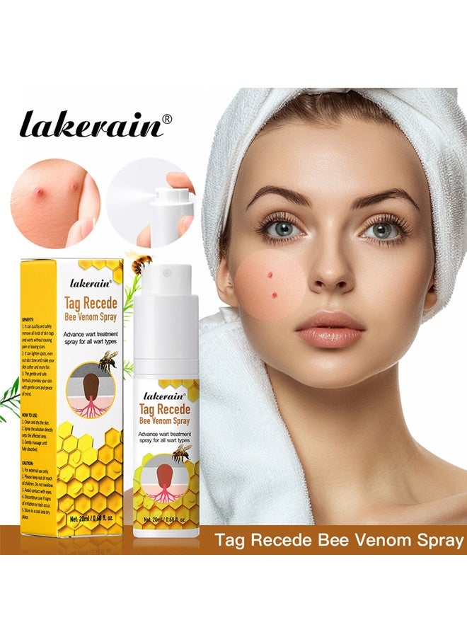 lakerain Tag Recede Bee Venom Spray Wart Treatment Spray Bee Venom Wart and Skin Tags Removal Treatment Spray Wart Remover Bee Venom Skin Tag Removal Spray Acne Removal Spray - Image 1