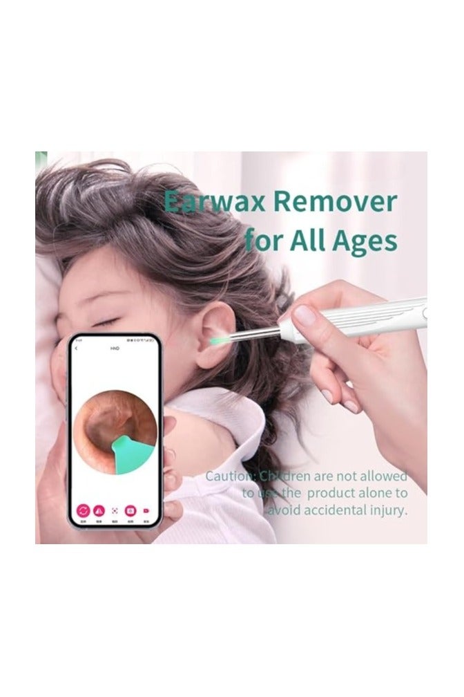 Dr.isla منظف الأذن الذكي Dr.isla P2 – جهاز واي فاي مزود بكاميرا دقيقة 500 واط لإزالة الشمع برؤية واضحة - Image 5