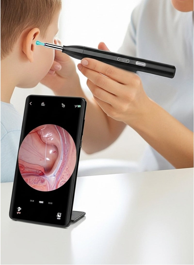 Dr.isla P2 Smart WiFi Ear Cleaner – HD Endoscopic Wax Remover with 500W Camera, Visual Ear Picking Tool with Silicone Heads - Image 4