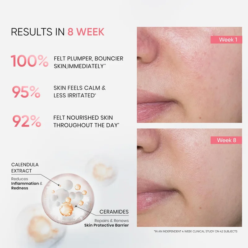 Skininspired Ceramide Moisturiser Cream For Hydration SkinInspired Ceramide Moisturizer Cream, For Inflammation, Barrier Repair, Eczema, Psoriasis | Face Moisturiser For Normal to Dry Skin & Moisturizing Cream for women & men (50g) for Women | Best Price UAE