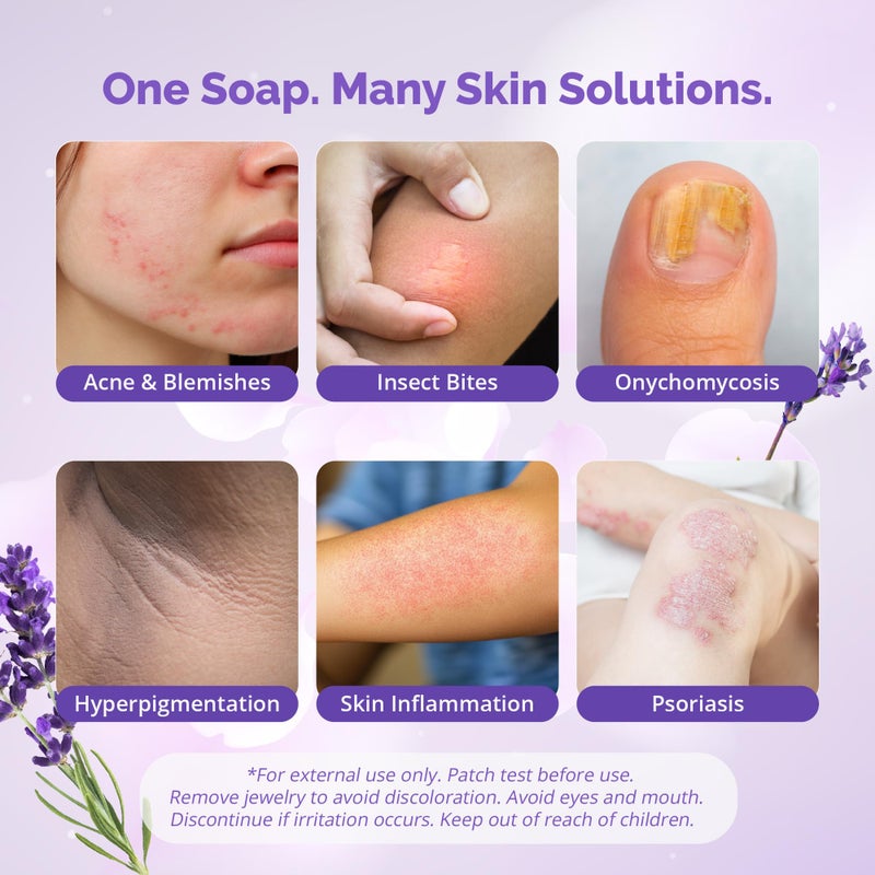 Naturasil Sulfur Lavender Soap Bar Natural Skin Treatment for Acne, Bug Bites, Warts Treatment, Viral Bumps, Nodes & Itching | for Kids & Adults |113 grams - Image 3