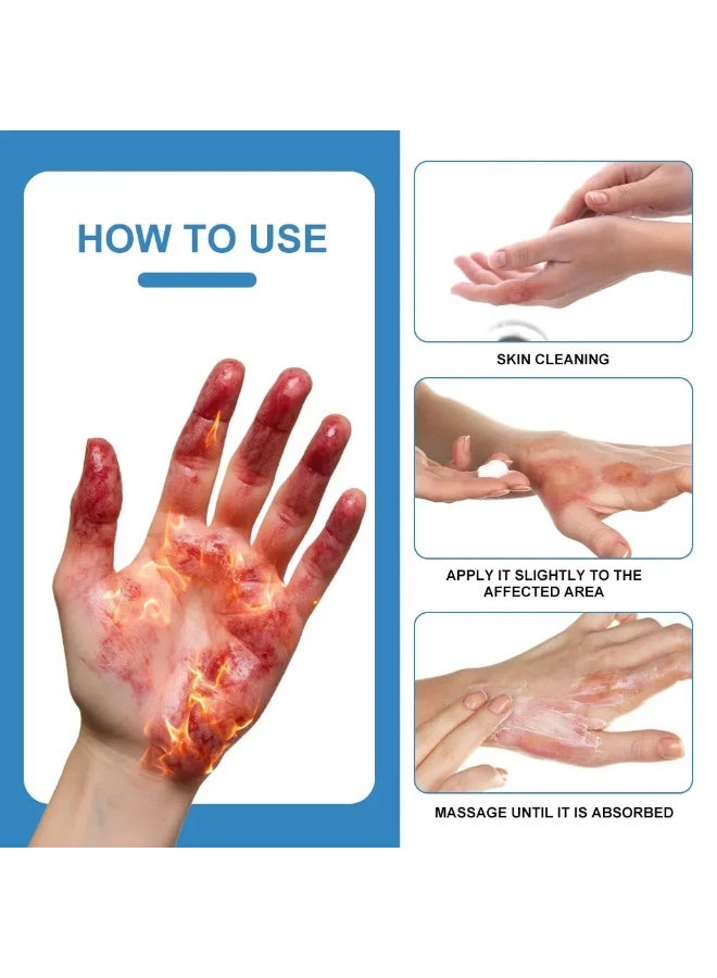 Sumifun Wound Care Cream with Antibacterial Protection, Designed for Minor Cuts, Burns, Surgical Wounds and Skin Abrasions, Helps Speed Healing and Reduce Infection - Image 4