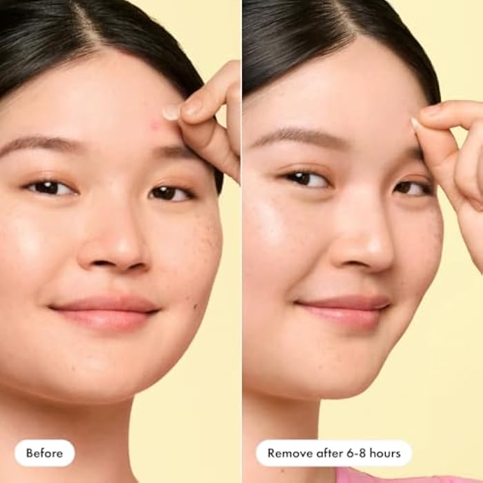 Mighty Patch Mini Invisible+ Patches - X-Small Daytime Hydrocolloid Acne Pimple Patches for Covering Zits & Blemishes, Blends Into Skin & Barely There (30 Count, 10mm Patch) - Image 5