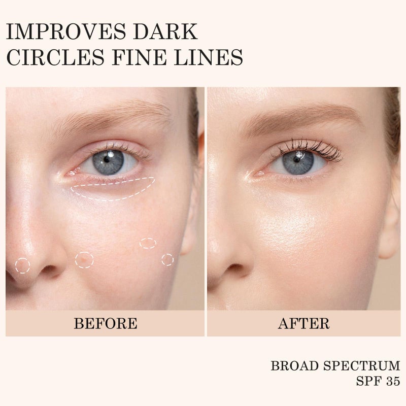 KYDA Mineral Eye Cream, Tined Eye Cream Color Corrector, 3-in-1 Anti-Aging Eye Cream for Dark Circle and Fine Lines, SPF 35, Light - Image 3