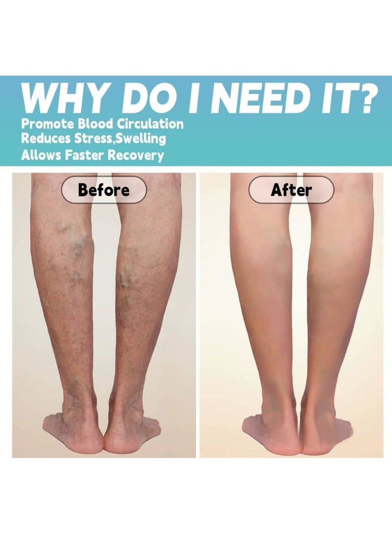 SOLARAE جوارب ضغط، عبوة 4 للنساء والرجال، جوارب ضغط 20-30 مم زئبق، جوارب دعم عالية الركبة مع وسادة دعم متدرجة - Image 3