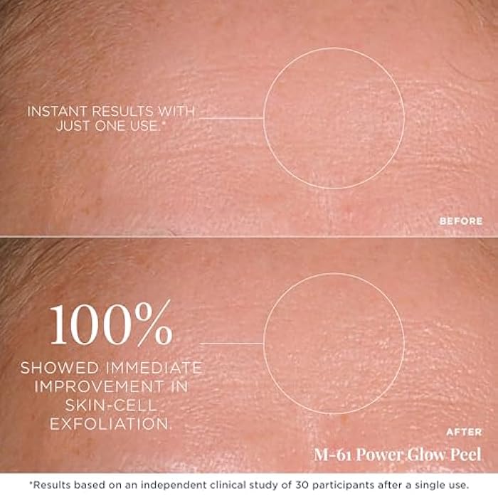 m-61 PowerGlow Peel | Exfoliating Facial Peel With Glycolic, Salicylic Acid. 1 Minute, 1 Step - 30 Treatments - Image 4