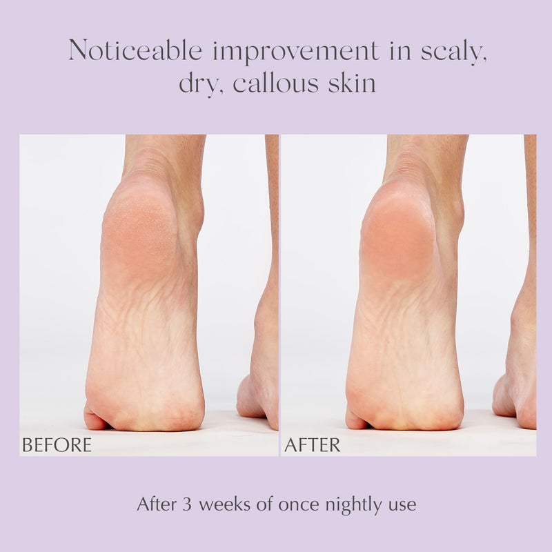 EXUVIANCE Exfoliating & Conditioning Foot Balm, 1.7 oz - Image 5