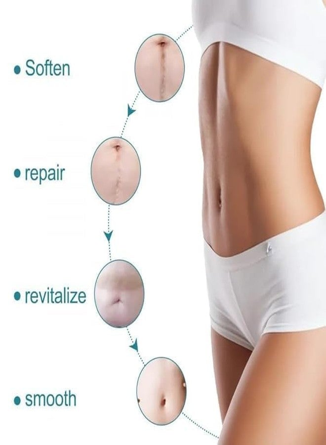Jaimin Creation Scar Removal Silicon Tape Scar Removal Sheet Strips for C-Section, Acne Scars, Tummy Tuck, Keloid and Surgical Scars, Reusable Medical Grade Silicone Scar Tape, Get Scars Away Painless Reusable - Image 5