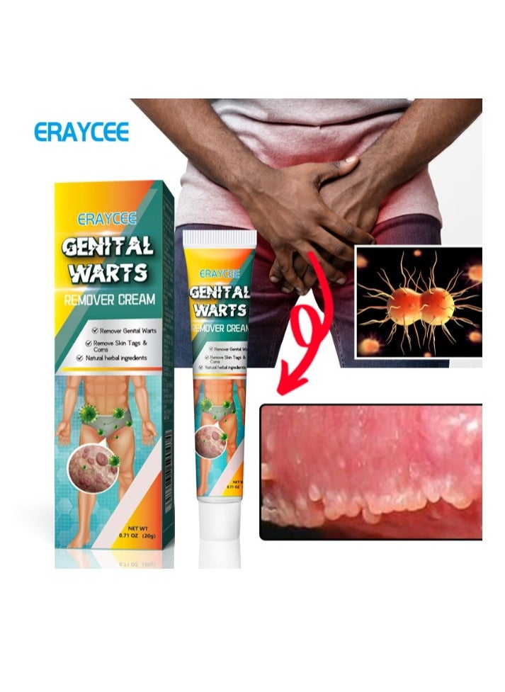 ERAYCEE Wart Removal Cream, A Gentle Safe Portable Wart Removal Cream with Natural Extracts for All Skin Types，Universal for Both Men and Women Wart Removal .Protecting Health and Beauty 20g  - Image 1
