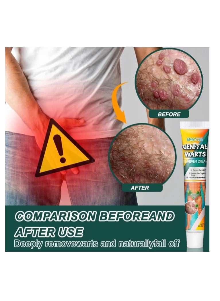 ERAYCEE Wart Removal Cream, A Gentle Safe Portable Wart Removal Cream with Natural Extracts for All Skin Types，Universal for Both Men and Women Wart Removal .Protecting Health and Beauty 20g  - Image 2