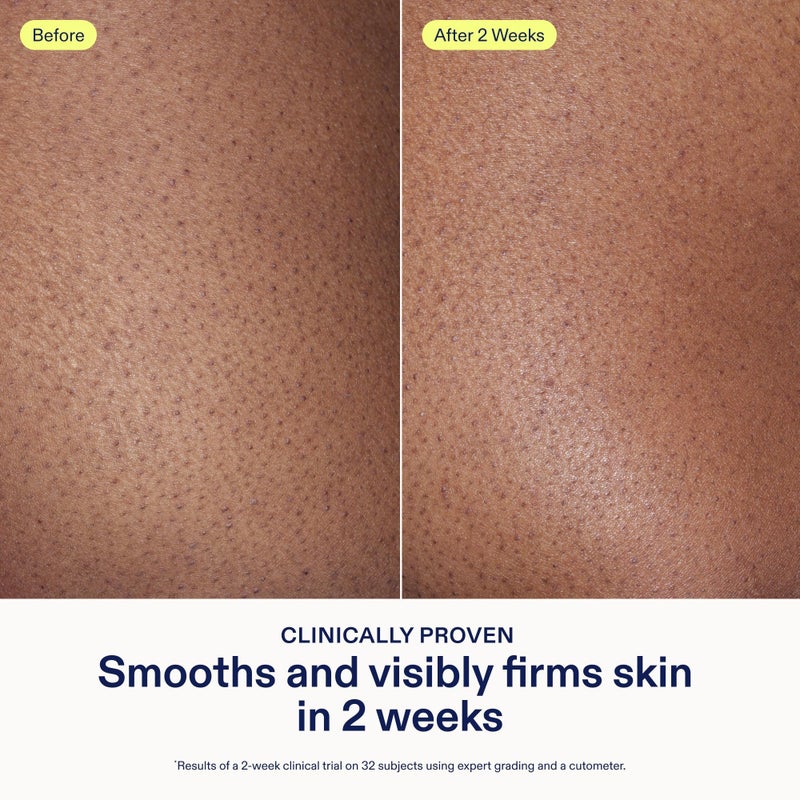 Skinfix AHA/BHA Renewing Body Cream - 10 oz - Skin-Softening Moisturizer with Gentle Exfoliation - Boosts Glow & Radiance - Vegan, Cruelty Free - Image 3